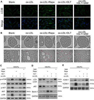 Danlou Tablet Activates Autophagy of Vascular Adventitial Fibroblasts Through PI3K/Akt/mTOR to Protect Cells From Damage Caused by Atherosclerosis